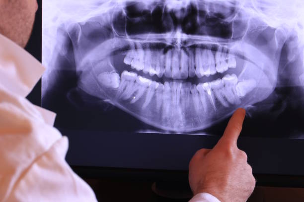 Tooth Infection Emergency Dentist in MN